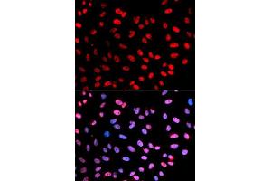 Immunofluorescent staining of U-2 OS cells with ESPL1 (phospho S1126) polyclonal antibody  at 1:20-1:100 dilution. (Separase Antikörper  (pSer1126))