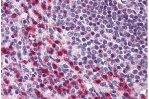 Human Spleen (formalin-fixed, paraffin-embedded) stained with BCLAF1 antibody ABIN296759 at 10 ug/ml followed by biotinylated goat anti-rabbit IgG secondary antibody ABIN481713, alkaline phosphatase-streptavidin and chromogen. (BCLAF1 Antikörper  (AA 700-750))