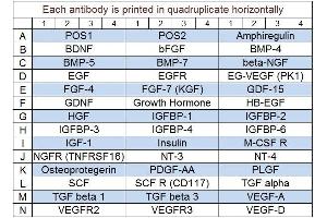 Image no. 1 for Human Growth Factor Array Q1 (ABIN625732) (Human Growth Factor Array Q1)