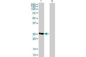 Western Blot analysis of C19orf43 expression in transfected 293T cell line by C19orf43 MaxPab polyclonal antibody. (C19orf43 Antikörper  (AA 1-176))