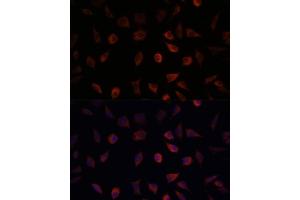 Immunofluorescence analysis of L929 cells using F antibody (ABIN6131636, ABIN6140414, ABIN6140415 and ABIN6220935) at dilution of 1:100. (FABP1 Antikörper  (AA 1-127))
