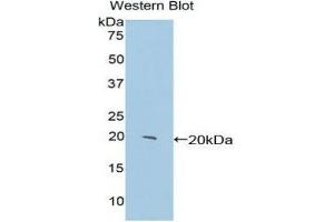Western Blotting (WB) image for anti-Centromere Protein E, 312kDa (CENPE) (AA 2222-2361) antibody (ABIN1858364) (CENPE Antikörper  (AA 2222-2361))