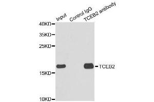 Immunoprecipitation analysis of 150ug extracts of MCF7 cells using 3ug TCEB2 antibody. (TCEB2 Antikörper  (AA 1-118))