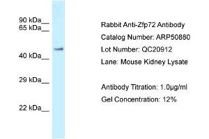 WB Suggested Anti-Zfp72 Antibody   Titration: 1.