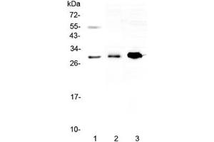 Western blot testing of 1) human 22RV1, 2) rat skeletal muscle and 3) mouse HEPA1-6 lysate with VEGFB antibody at 0. (VEGFB (VEGF2) Antikörper)
