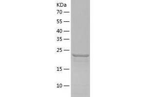 Proteasome Subunit alpha 6 (PSMA6) (AA 1-246) protein (His-IF2DI Tag)