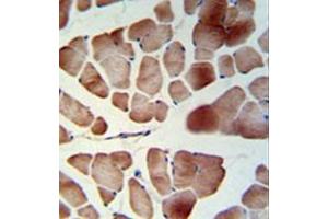 Immunohistochemistry analysis in formalin fixed and paraffin embedded skeletal muscle reacted with PATL1 Antibody (C-term) followed which was peroxidase conjugated to the secondary antibody and followed by DAB staining. (PATL1 Antikörper  (C-Term))