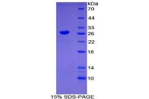 SDS-PAGE (SDS) image for C-Type Lectin Domain Family 10, Member A (CLEC10A) (AA 69-273) protein (His tag) (ABIN1879586)