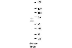DONSON antibody - middle region  validated by WB using Mouse brains at 1:1000. (DONSON Antikörper  (Middle Region))