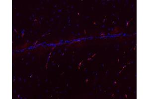 Indirect immunofluorescence labeling of PFA fixed, paraffin embedded mouse brain section (dilution 1 : 500; red). (MCTS1 Antikörper)