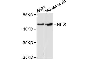 Western blot analysis of extracts of various cell lines, using NFIX antibody. (NFIX Antikörper)
