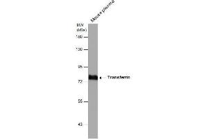 WB Image Mouse tissue extract (50 μg) was separated by 7. (Transferrin Antikörper)