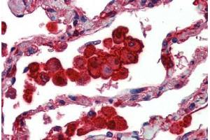 Human Lung: Formalin-Fixed, Paraffin-Embedded (FFPE)