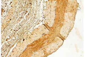 ABIN6262483 and ABIN6272845 at 1/100 staining Mouse skin tissue by IHC-P. (IFT88 Antikörper  (C-Term))