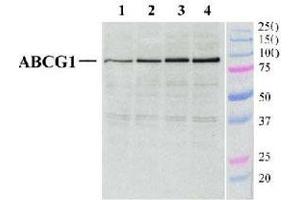 Detection of ABCG1 in mouse peritoneal macrophages (40 ug) using ABCG1 polyclonal antibody .