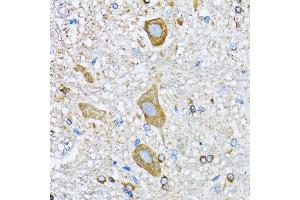 Immunohistochemistry (IHC) image for anti-Histone Deacetylase 5 (HDAC5) (AA 550-650) antibody (ABIN6141675)
