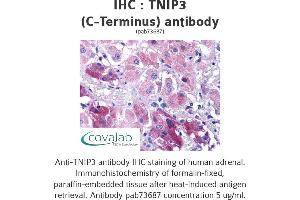Image no. 1 for anti-TNFAIP3 Interacting Protein 3 (TNIP3) (C-Term) antibody (ABIN1740204) (TNIP3 Antikörper  (C-Term))