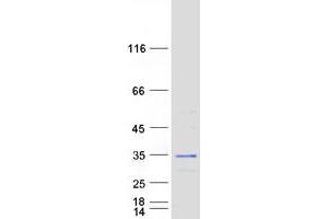 Validation with Western Blot