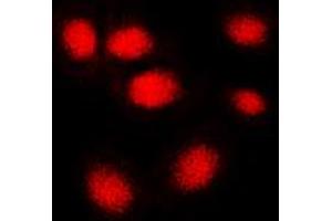 Immunofluorescent analysis of hNRNP C staining in MCF7 cells.