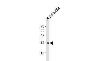 Western Blotting (WB) image for anti-Acidic (Leucine-Rich) Nuclear phosphoprotein 32 Family, Member B (ANP32B) (AA 17-45), (N-Term) antibody (ABIN1539101)