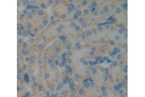IHC-P analysis of Kidney tissue, with DAB staining. (COQ6 Antikörper  (AA 1-476))