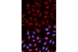 Immunofluorescence (IF) image for anti-Transducin-Like Enhancer of Split 1 (E(sp1) Homolog, Drosophila) (TLE1) antibody (ABIN1876687) (TLE1 Antikörper)