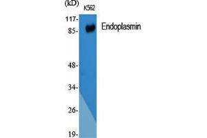 Western Blot (WB) analysis of specific cells using Endoplasmin Polyclonal Antibody.