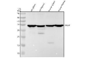 Western blot analysis of TIRAP using anti-TIRAP antibody (ABIN7606519).