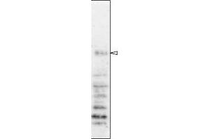 Western Blotting (WB) image for anti-Nucleoporin 98kDa (NUP98) (AA 1-466) antibody (ABIN2452066)
