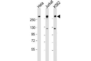 All lanes : Anti-CHD3 Antibody (N-Term) at 1:1000-1:2000 dilution Lane 1: Hela whole cell lysate Lane 2: Jurkat whole cell lysate Lane 3: K562 whole cell lysate Lysates/proteins at 20 μg per lane. (CHD3 Antikörper  (AA 595-629))