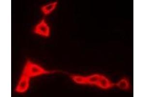 Immunofluorescence (IF) image for anti-Major Histocompatibility Complex, Class II, DR beta 1 (HLA-DRB1) antibody (ABIN7307126)
