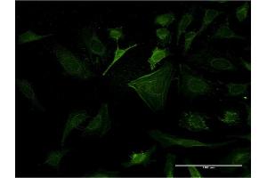 Immunofluorescence of monoclonal antibody to CASP10 on HeLa cell.