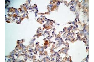 Immunohistochemistry (IHC) image for anti-Cathelicidin Antimicrobial Peptide (CAMP) (AA 140-173) antibody (ABIN2873275)