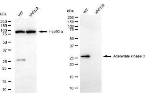 Western blotting analysis using adenylate kinase 3 antibody (ABIN7797521). (Adenylate Kinase 3 Antikörper)