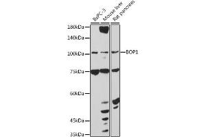 Western blot analysis of extracts of various cell lines, using BOP1 antibody (ABIN7265887) at 1:1000 dilution. (BOP1 Antikörper  (AA 600-680))