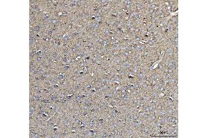 IHC analysis of CD90/Thy1 using anti-CD90/Thy1 antibody (ABIN5518877). (CD90 Antikörper  (AA 20-131))