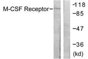Western Blotting (WB) image for anti-Colony Stimulating Factor 1 Receptor (CSF1R) (AA 781-830) antibody (ABIN2888675) (CSF1R Antikörper  (AA 781-830))