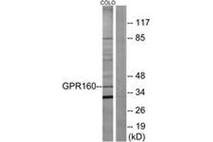 Western blot analysis of extracts from COLO205 cells, using GPR160 Antibody. (GPR160 Antikörper  (AA 289-338))