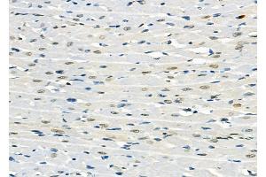 ABIN6257906 and ABIN6274713 at 1/100 staining Rat heart tissue by IHC-P. (AGPAT3 Antikörper  (Internal Region))