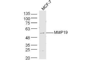 Human MCF-7 cell lysates probed with Rabbit Anti-MMP19 Polyclonal Antibody, Unconjugated  at 1:500 for 90 min at 37˚C. (MMP19 Antikörper  (AA 251-350))