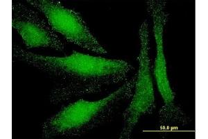 Immunofluorescence of monoclonal antibody to LMO3 on HeLa cell. (LMO3 Antikörper  (AA 91-146))