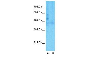 Host:  Rabbit  Target Name:  LSR  Sample Type:  Human Fetal Liver  Lane A:  Primary Antibody  Lane B:  Primary Antibody + Blocking Peptide  Primary Antibody Concentration:  1ug/ml  Peptide Concentration:  5ug/ml  Lysate Quantity:  25ug/lane/lane  Gel Concentration:  0. (LSR Antikörper  (C-Term))