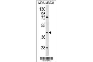 Western blot analysis of HOMER3 Antibody in MDA-MB231 cell line lysates (35ug/lane)