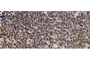 Immunohistochemistry of paraffin-embedded Human tonsil tissue using SIK3 Polyclonal Antibody at dilution of 1:60(x200) (SIK3 Antikörper)