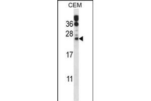 RAB6B Antibody (C-term) (ABIN657771 and ABIN2846747) western blot analysis in CEM cell line lysates (35 μg/lane). (RAB6B Antikörper  (C-Term))