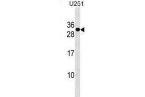 Western Blotting (WB) image for anti-POM121 and ZP3 Fusion (POMZP3) antibody (ABIN3000214)