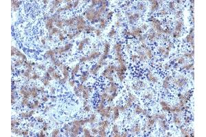 Formalin-fixed, paraffin-embedded human Fetal Liver stained with Glypican-3 Rabbit Recombinant Monoclonal Antibody (GPC3/1534R). (Glypican 3 Antikörper)