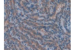 Immunohistochemistry (IHC) image for anti-Collagen, Type IV, alpha 1 (COL4A1) (AA 1444-1669) antibody (ABIN7431209)