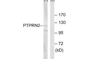 Western blot analysis of extracts from NIH/3T3 cells, using PTPRN2 antibody. (PTPRN2 Antikörper  (Internal Region))