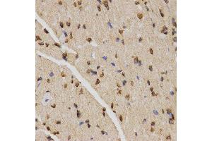 Immunohistochemistry (Paraffin-embedded Sections) (IHC (p)) image for anti-Histone H4 (3meLys20) antibody (ABIN3016051)